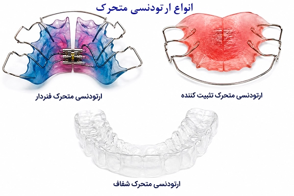 انواع ارتودنسی متحرک