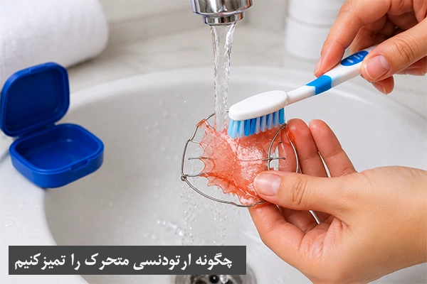 چگونه ارتودنسی متحرک را تمیز کنیم