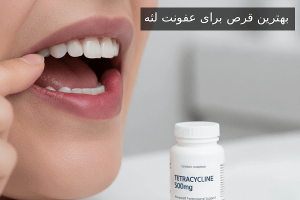بهترین قرص برای عفونت لثه