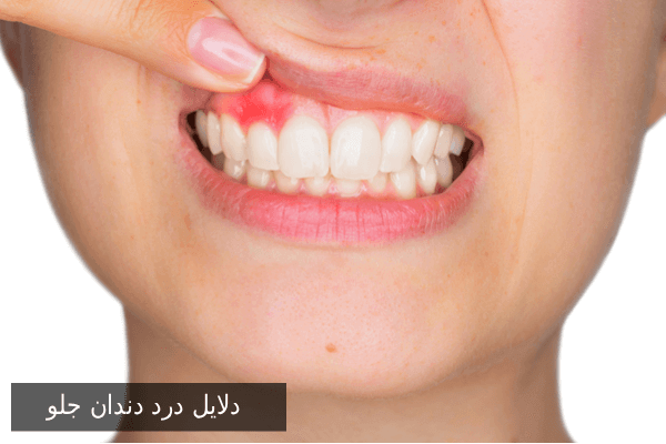 دلایل درد دندان جلو با توضیح