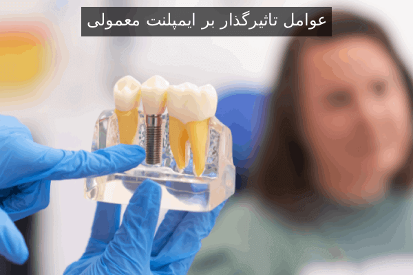 عوامل تاثیرگذار بر ایمپلنت معمولی