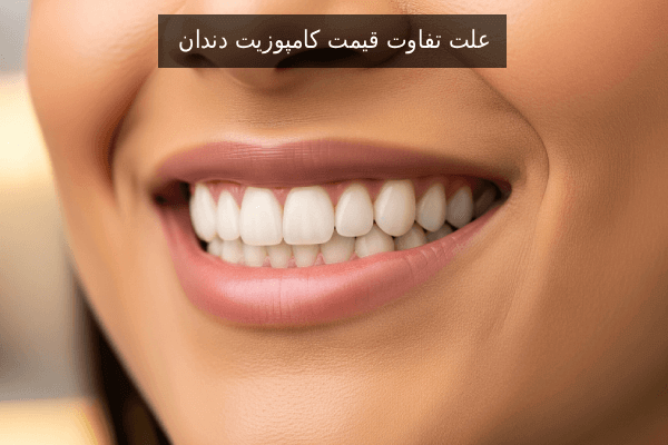علت تفاوت قیمت کامپوزیت دندان