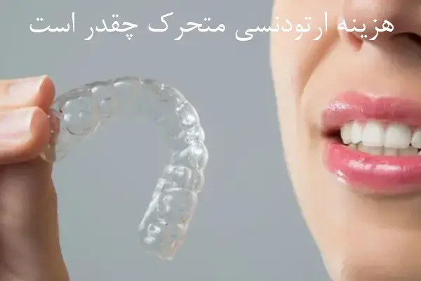 هزینه ارتودنسی متحرک چقدر است؟
