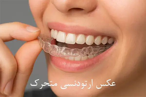 عکس ارتودنسی متحرک