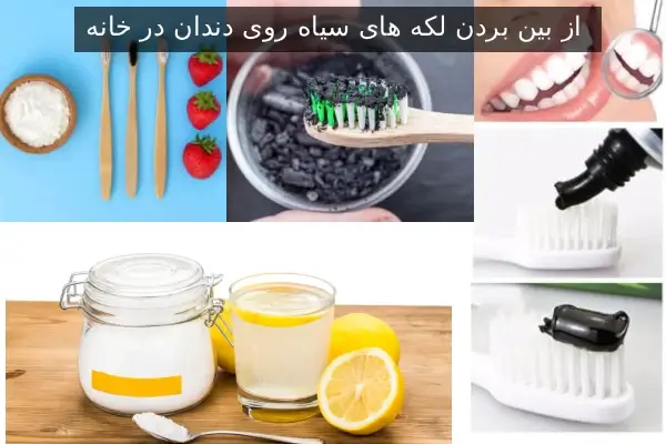 از بین بردن لکه های سیاه روی دندان در خانه