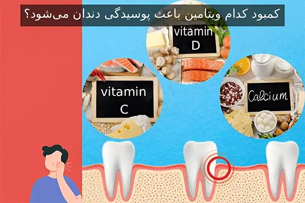 دندانپزشکی طرف قرارداد انواع بیمه ها