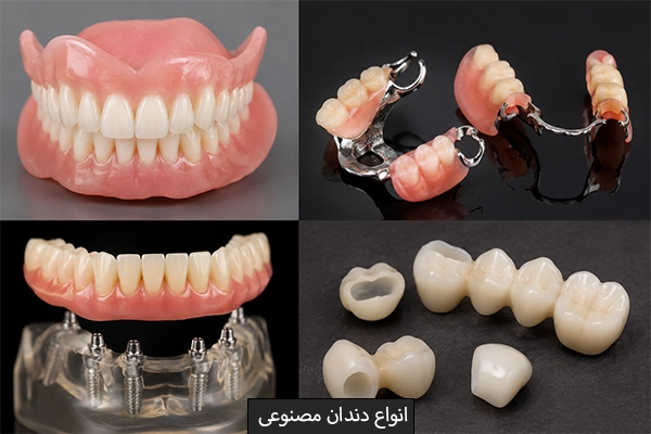 انواع دندان مصنوعی