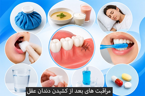 مراقبت های بعد از کشیدن دندان عقل