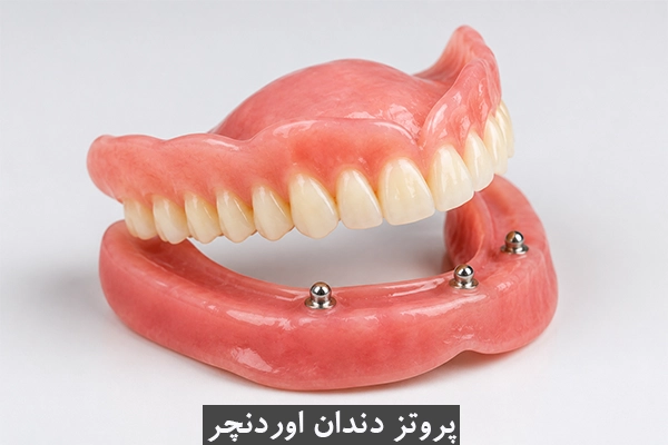 دندان مصنوعی پروتز دندان اوردنچر