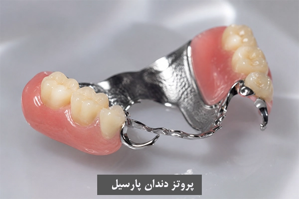 پروتز دندان پارسیل