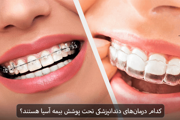کدام درمان های دندانپزشکی تحت پوشش بیمه آسیا هستند؟
