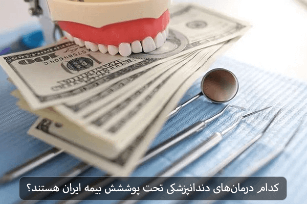 کدام درمان های دندانپزشکی تحت پوششش بیمه ایران هستند؟