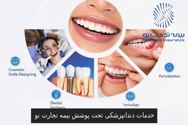 خدمات دندانپزشکی تحت پوشش بیمه تجارت نو